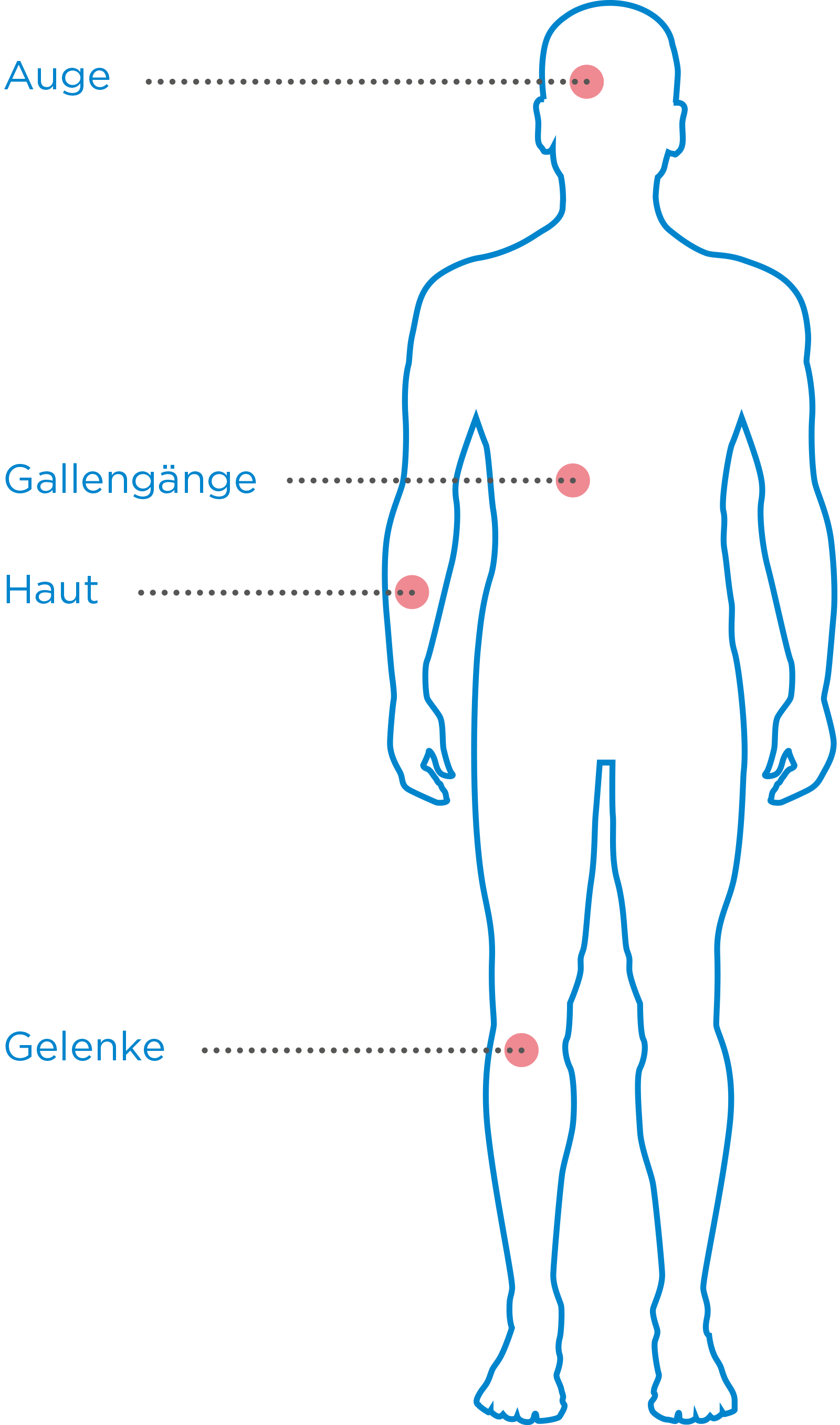 Folgen von Colitis ulcerosa Shilhouette