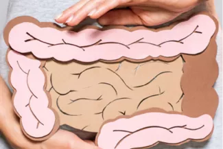 Colitis ulcerosa Erkrankung